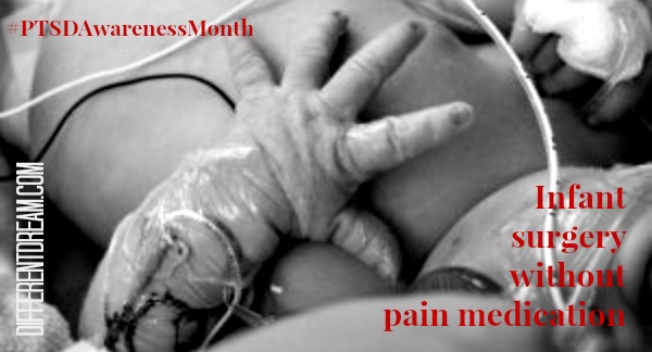 Can You Imagine Infant Surgery Without Anesthesia?