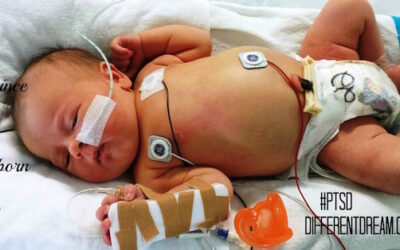 Newborns Feel Pain: The Headline that Almost Triggered my PTSD