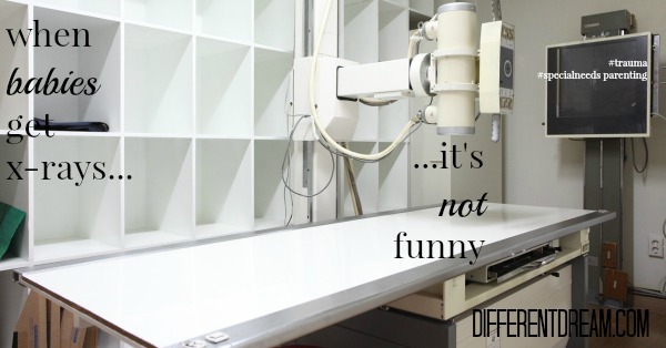 Why Pediatric X-Rays Aren’t Something to Laugh About