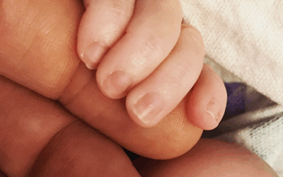 5 Tips for New Dads with an EA TEF Baby
