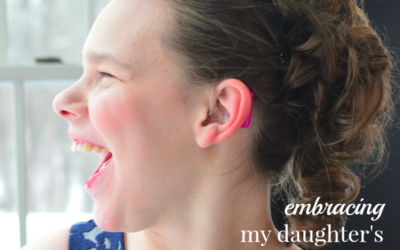 Embracing My Daughter’s Special Needs Sweet Sixteen